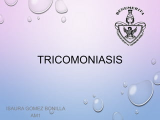 TRICOMONIASIS
ISAURA GOMEZ BONILLA
AM1
 