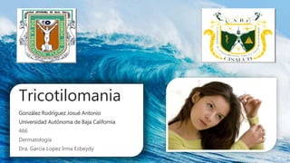 Tricotilomania
González Rodríguez Josué Antonio
Universidad Autónoma de Baja California
466
Dermatología
Dra. Garcia Lopez Irma Esbeydy
 