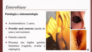 Enterobíase
8
Patologia e sintomatologia
● Assintomáticos: ↑ casos.
● Prurido anal noturno (perda de
sono e nervosismo).
● Enterite catarral.
● Presença nos órgãos genitais
femininos (vaginite, ovarite e
salpingite).
 