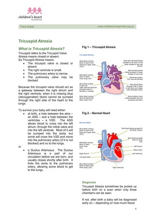 1
Fact sheet www.childrens-heart-fed.org.uk
Tricuspid Atresia
What is Tricuspid Atresia?
Tricuspid refers to the Tricuspid Valve.
Atresia means closed or absent.
So Tricuspid Atresia means:
• The tricuspid valve is closed or
absent.
• The right ventricle is small.
• The pulmonary artery is narrow.
• The pulmonary valve may be
blocked.
Because the tricuspid valve should act as
a gateway between the right atrium and
the right ventricle, when it is missing blue
(deoxygenated) blood cannot be pumped
through the right side of the heart to the
lungs.
To survive your baby will need either:
• at birth, a hole between the atria –
an ASD – and a hole between the
ventricles – a VSD. The ASD
allows blood to cross into the left
atrium, through the mitral valve and
into the left ventricle. Most of it will
be pumped into the aorta, but
some will cross the VSD and move
into the pulmonary artery (if it is not
blocked) and so to the lungs.
or
• a Ductus Arteriosus. The Ductus
Arteriosus is a part of our
circulation before we are born, and
usually closes shortly after birth. It
links the aorta to the pulmonary
artery, allowing some blood to get
to the lungs.
Fig 1 – Tricuspid Atresia
Fig 2 – Normal Heart
Diagnosis
Tricuspid Atresia sometimes be picked up
before birth on a scan when only three
chambers can be seen.
If not, after birth a baby will be diagnosed
early on – depending on how much blood
 