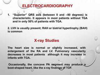 ELECTROCARDIOGRAPHY
1. “Superior” QRS axis (between 0 and –90 degrees) is
characteristic. It appears in most patients without TGA
and in only 50% of patients with TGA.
2. LVH is usually present; RAH or biatrial hypertrophy (BAH)
is common
X-ray Studies
The heart size is normal or slightly increased, with
enlargement of the RA and LV. Pulmonary vascularity
decreases in most patients although it may increase in
infants with TGA.
Occasionally, the concave PA segment may produce a
boot-shaped heart, like the x-ray findings of TOF.
 