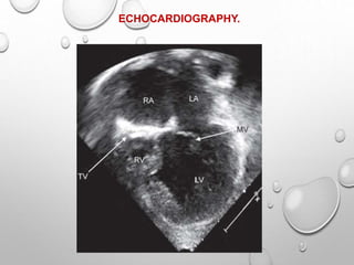 ECHOCARDIOGRAPHY.
 