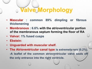Valve Morphology
• Mascular : common 89% dimpling or fibrous
thickenening
• Membranous : 6.6% with the atrioventricular portion
of the membranous septum forming the floor of RA
• Valvar: 1% fused cusps
• Ebstein:
• Unguarded with muscular shelf.
• The Atrioventricular canal type is extremely rare (0.2%).
-A leaflet of the common atrioventricular valve seals off
the only entrance into the right ventricle.
 
