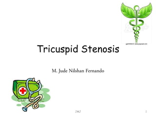 Tricuspid Stenosis
M. Jude Nilshan Fernando
JMJ 1
 