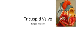 Tricuspid Valve 
Surgical Anatomy 
 