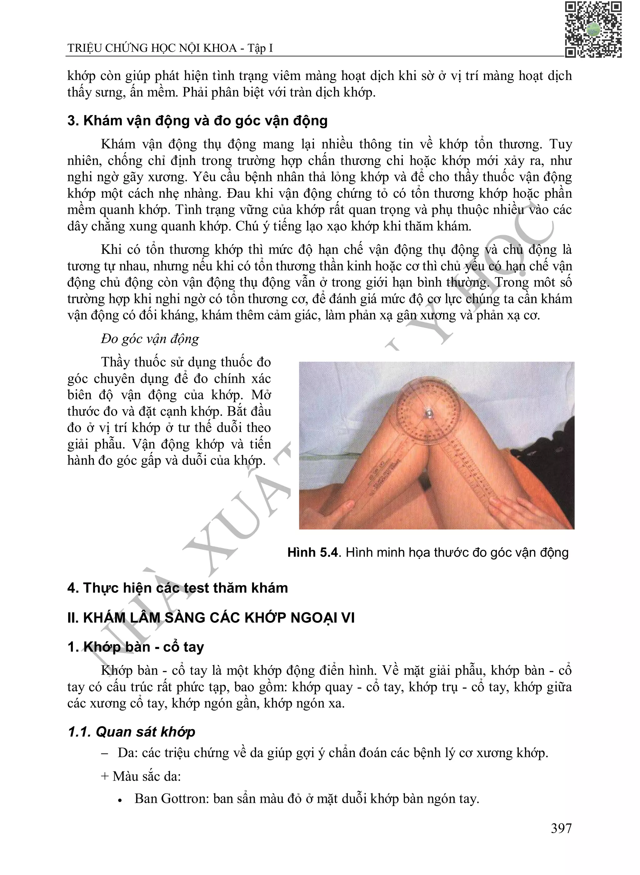 N
H
À
X
U
Ấ
T
B
Ả
N
Y
H
Ọ
C
TRIỆU CHỨNG HỌC NỘI KHOA - Tập I
397
khớp còn giúp phát hiện tình trạng viêm màng hoạt dịch khi sờ ở vị trí màng hoạt dịch
thấy sưng, ấn mềm. Phải phân biệt với tràn dịch khớp.
3. Khám vận động và đo góc vận động
Khám vận động thụ động mang lại nhiều thông tin về khớp tổn thương. Tuy
nhiên, chống chỉ định trong trường hợp chấn thương chi hoặc khớp mới xảy ra, như
nghi ngờ gãy xương. Yêu cầu bệnh nhân thả lỏng khớp và để cho thầy thuốc vận động
khớp một cách nhẹ nhàng. Đau khi vận động chứng tỏ có tổn thương khớp hoặc phần
mềm quanh khớp. Tình trạng vững của khớp rất quan trọng và phụ thuộc nhiều vào các
dây chằng xung quanh khớp. Chú ý tiếng lạo xạo khớp khi thăm khám.
Khi có tổn thương khớp thì mức độ hạn chế vận động thụ động và chủ động là
tương tự nhau, nhưng nếu khi có tổn thương thần kinh hoặc cơ thì chủ yếu có hạn chế vận
động chủ động còn vận động thụ động vẫn ở trong giới hạn bình thường. Trong môt số
trường hợp khi nghi ngờ có tổn thương cơ, để đánh giá mức độ cơ lực chúng ta cần khám
vận động có đối kháng, khám thêm cảm giác, làm phản xạ gân xương và phản xạ cơ.
Đo góc vận động
Thầy thuốc sử dụng thuốc đo
góc chuyên dụng để đo chính xác
biên độ vận động của khớp. Mở
thước đo và đặt cạnh khớp. Bắt đầu
đo ở vị trí khớp ở tư thế duỗi theo
giải phẫu. Vận động khớp và tiến
hành đo góc gấp và duỗi của khớp.
Hình 5.4. Hình minh họa thước đo góc vận động
4. Thực hiện các test thăm khám
II. KHÁM LÂM SÀNG CÁC KHỚP NGOẠI VI
1. Khớp bàn - cổ tay
Khớp bàn - cổ tay là một khớp động điển hình. Về mặt giải phẫu, khớp bàn - cổ
tay có cấu trúc rất phức tạp, bao gồm: khớp quay - cổ tay, khớp trụ - cổ tay, khớp giữa
các xương cổ tay, khớp ngón gần, khớp ngón xa.
1.1. Quan sát khớp
 Da: các triệu chứng về da giúp gợi ý chẩn đoán các bệnh lý cơ xương khớp.
+ Màu sắc da:
 Ban Gottron: ban sẩn màu đỏ ở mặt duỗi khớp bàn ngón tay.
 