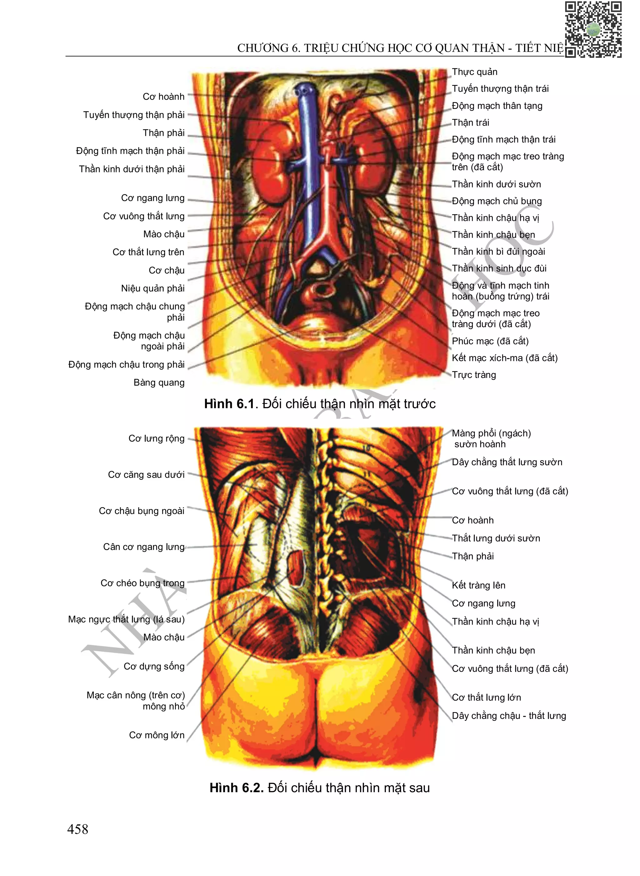 N
H
À
X
U
Ấ
T
B
Ả
N
Y
H
Ọ
C
CHƯƠNG 6. TRIỆU CHỨNG HỌC CƠ QUAN THẬN - TIẾT NIỆU
458
Hình 6.1. Đối chiếu thận nhìn mặt trước
Hình 6.2. Đối chiếu thận nhìn mặt sau
Cơ hoành
Tuyến thượng thận phải
Thận phải
Động tĩnh mạch thận phải
Thần kinh dưới thận phải
Cơ ngang lưng
Cơ vuông thắt lưng
Mào chậu
Cơ thắt lưng trên
Cơ chậu
Niệu quản phải
Động mạch chậu chung
phải
Động mạch chậu
ngoài phải
Động mạch chậu trong phải
Bàng quang
Thực quản
Tuyến thượng thận trái
Động mạch thân tạng
Thận trái
Động tĩnh mạch thận trái
Động mạch mạc treo tràng
trên (đã cắt)
Thần kinh dưới sườn
Động mạch chủ bụng
Thần kinh chậu hạ vị
Thần kinh chậu bẹn
Thần kinh bì đùi ngoài
Thần kinh sinh dục đùi
Động và tĩnh mạch tinh
hoàn (buồng trứng) trái
Động mạch mạc treo
tràng dưới (đã cắt)
Phúc mạc (đã cắt)
Kết mạc xích-ma (đã cắt)
Trực tràng
Cơ lưng rộng
Cơ căng sau dưới
Cơ chậu bụng ngoài
Cân cơ ngang lưng
Cơ chéo bụng trong
Mạc ngực thắt lưng (lá sau)
Mào chậu
Cơ dựng sống
Mạc cân nông (trên cơ)
mông nhỏ
Cơ mông lớn
Màng phổi (ngách)
sườn hoành
Dây chằng thắt lưng sườn
Cơ vuông thắt lưng (đã cắt)
Cơ hoành
Thắt lưng dưới sườn
Thận phải
Kết tràng lên
Cơ ngang lưng
Thần kinh chậu hạ vị
Thần kinh chậu bẹn
Cơ vuông thắt lưng (đã cắt)
Cơ thắt lưng lớn
Dây chằng chậu - thắt lưng
 