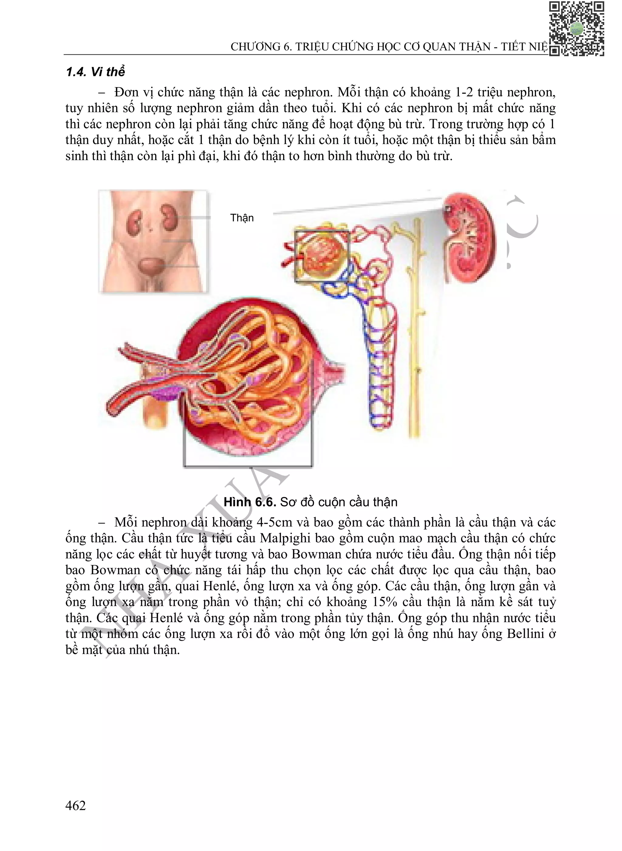 N
H
À
X
U
Ấ
T
B
Ả
N
Y
H
Ọ
C
CHƯƠNG 6. TRIỆU CHỨNG HỌC CƠ QUAN THẬN - TIẾT NIỆU
462
1.4. Vi thể
 Đơn vị chức năng thận là các nephron. Mỗi thận có khoảng 1-2 triệu nephron,
tuy nhiên số lượng nephron giảm dần theo tuổi. Khi có các nephron bị mất chức năng
thì các nephron còn lại phải tăng chức năng để hoạt động bù trừ. Trong trường hợp có 1
thận duy nhất, hoặc cắt 1 thận do bệnh lý khi còn ít tuổi, hoặc một thận bị thiểu sản bẩm
sinh thì thận còn lại phì đại, khi đó thận to hơn bình thường do bù trừ.
Hình 6.6. Sơ đồ cuộn cầu thận
 Mỗi nephron dài khoảng 4-5cm và bao gồm các thành phần là cầu thận và các
ống thận. Cầu thận tức là tiểu cầu Malpighi bao gồm cuộn mao mạch cầu thận có chức
năng lọc các chất từ huyết tương và bao Bowman chứa nước tiểu đầu. Ống thận nối tiếp
bao Bowman có chức năng tái hấp thu chọn lọc các chất được lọc qua cầu thận, bao
gồm ống lượn gần, quai Henlé, ống lượn xa và ống góp. Các cầu thận, ống lượn gần và
ống lượn xa nằm trong phần vỏ thận; chỉ có khoảng 15% cầu thận là nằm kề sát tuỷ
thận. Các quai Henlé và ống góp nằm trong phần tủy thận. Ống góp thu nhận nước tiểu
từ một nhóm các ống lượn xa rồi đổ vào một ống lớn gọi là ống nhú hay ống Bellini ở
bề mặt của nhú thận.
Thận
 