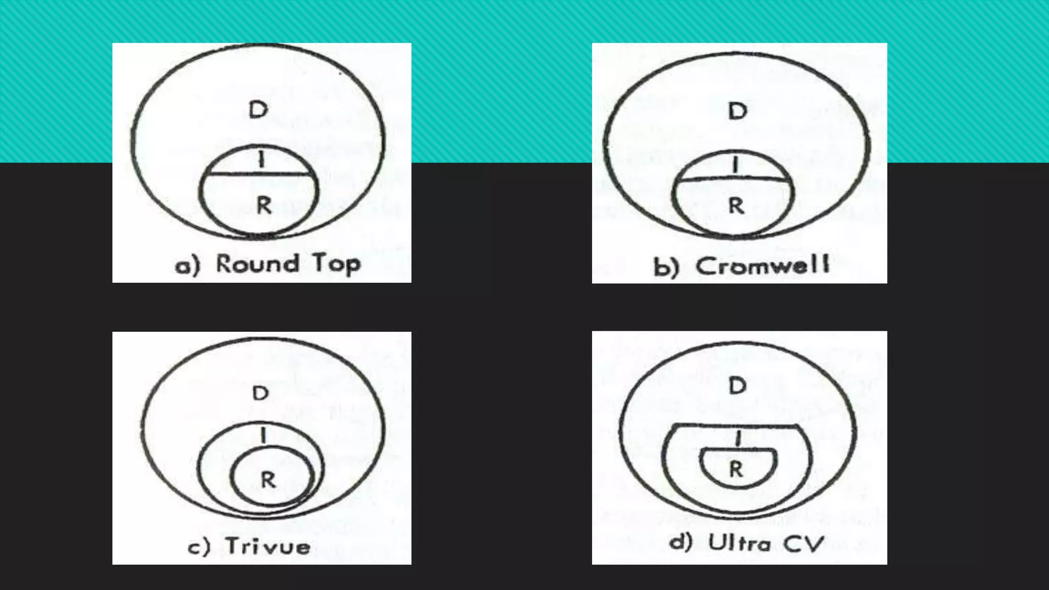Computer Trifocals Trifocals | PPTX