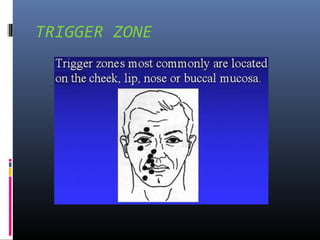 TRIGGER ZONE

 