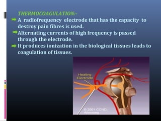 THERMOCOAGULATION:A radiofrequency electrode that has the capacity to
destroy pain fibres is used.
Alternating currents of high frequency is passed
through the electrode.
It produces ionization in the biological tissues leads to
coagulation of tissues.

 