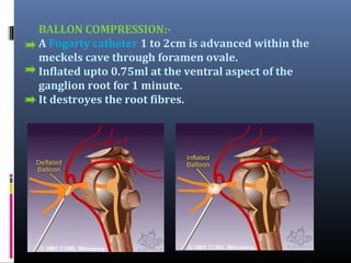 BALLON COMPRESSION:A Fogarty catheter 1 to 2cm is advanced within the
meckels cave through foramen ovale.
Inflated upto 0.75ml at the ventral aspect of the
ganglion root for 1 minute.
It destroyes the root fibres.

 