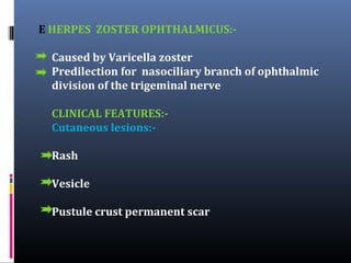 E HERPES ZOSTER OPHTHALMICUS:Caused by Varicella zoster
Predilection for nasociliary branch of ophthalmic
division of the trigeminal nerve
CLINICAL FEATURES:Cutaneous lesions:Rash
Vesicle
Pustule crust permanent scar

 