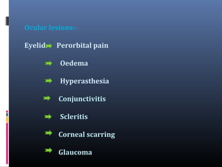 Ocular lesions:Eyelid:- Perorbital pain
Oedema
Hyperasthesia
Conjunctivitis
Scleritis
Corneal scarring
Glaucoma

 