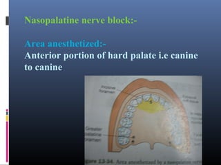 Nasopalatine nerve block:Area anesthetized:Anterior portion of hard palate i.e canine
to canine

 