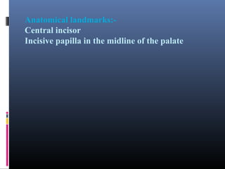 Anatomical landmarks:Central incisor
Incisive papilla in the midline of the palate

 