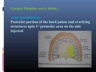 Greater Palatine nerve block:Area anesthetized:Posterior portion of the hard palate and overlying
structures upto 1st premolar area on the side
injected

 