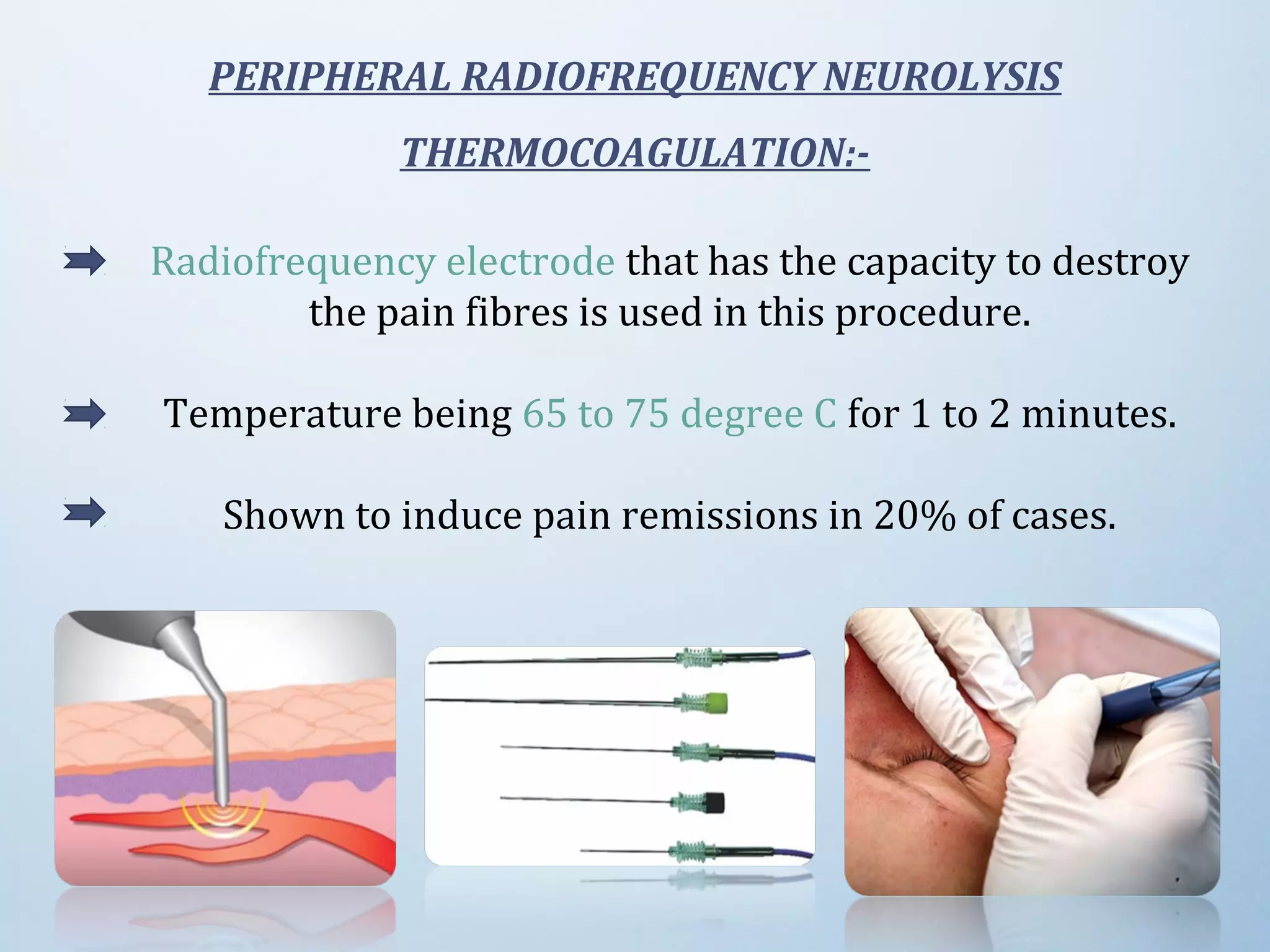 Radiofrequency electrode that has the capacity to destroy
the pain fibres is used in this procedure.
Temperature being 65 to 75 degree C for 1 to 2 minutes.
Shown to induce pain remissions in 20% of cases.
PERIPHERAL RADIOFREQUENCY NEUROLYSIS
THERMOCOAGULATION:-
 