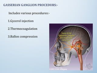 GASSERIAN GANGLION PROCEDURS:-
Includes various procedures:-
1.Gycerol injection
2.Thermocoagulation
3.Ballon compression
 