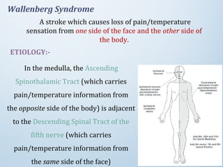 Wallenberg Syndrome
A stroke which causes loss of pain/temperature
sensation from one side of the face and the other side of
the body.
ETIOLOGY:-
In the medulla, the Ascending
Spinothalamic Tract (which carries
pain/temperature information from
the opposite side of the body) is adjacent
to the Descending Spinal Tract of the
fifth nerve (which carries
pain/temperature information from
the same side of the face)
 