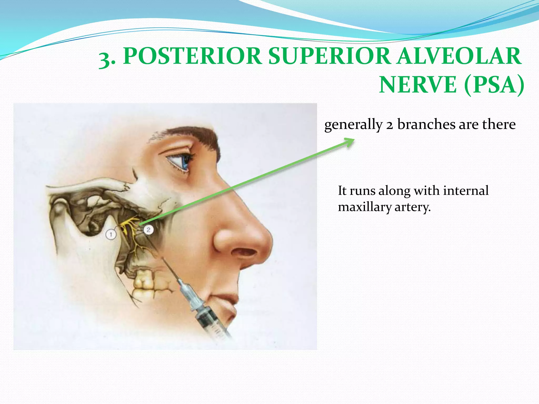 3. POSTERIOR SUPERIOR ALVEOLAR
NERVE (PSA)
generally 2 branches are there
It runs along with internal
maxillary artery.
 