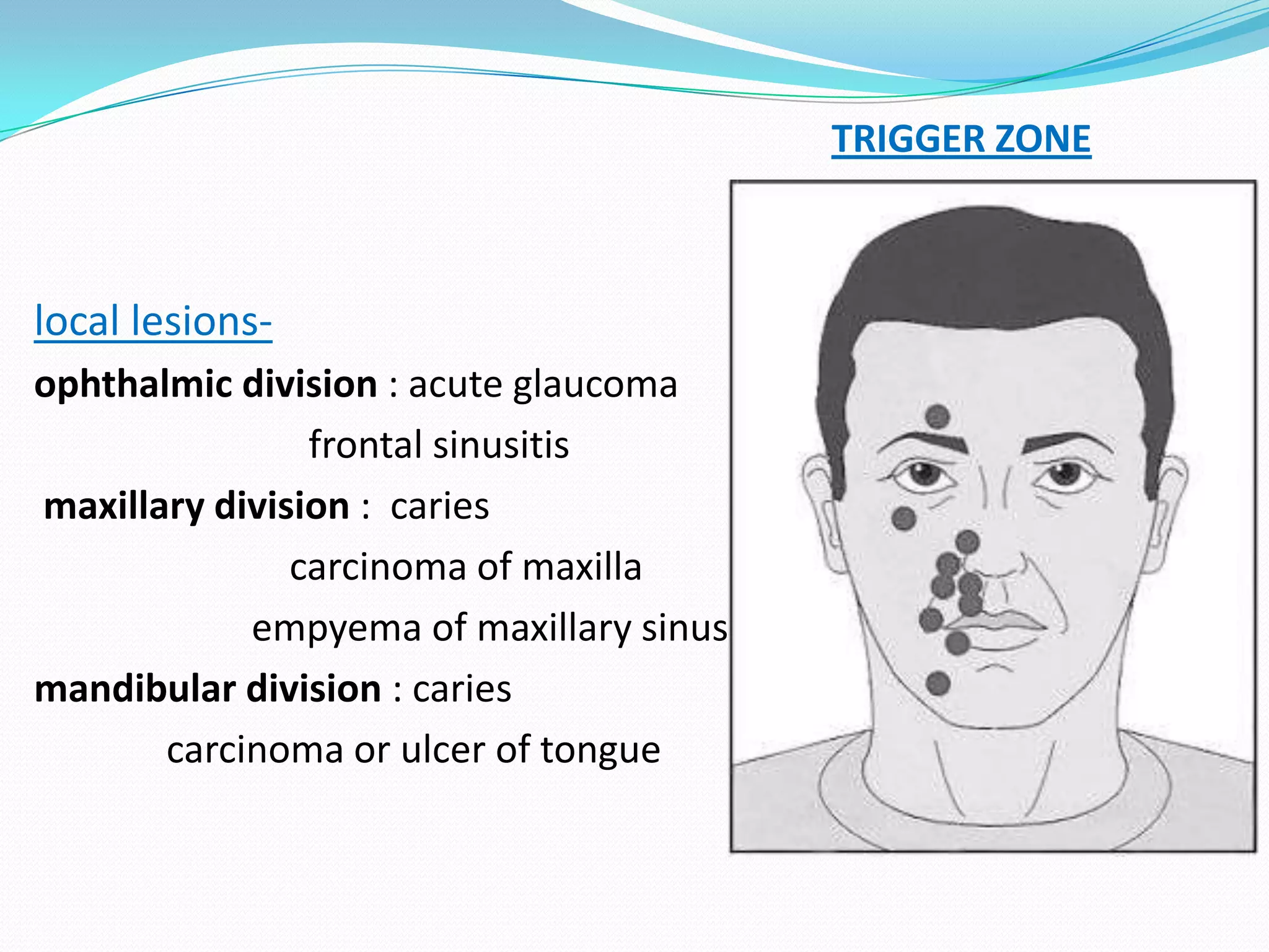 local lesions-
ophthalmic division : acute glaucoma
frontal sinusitis
maxillary division : caries
carcinoma of maxilla
empyema of maxillary sinus
mandibular division : caries
carcinoma or ulcer of tongue
TRIGGER ZONE
 