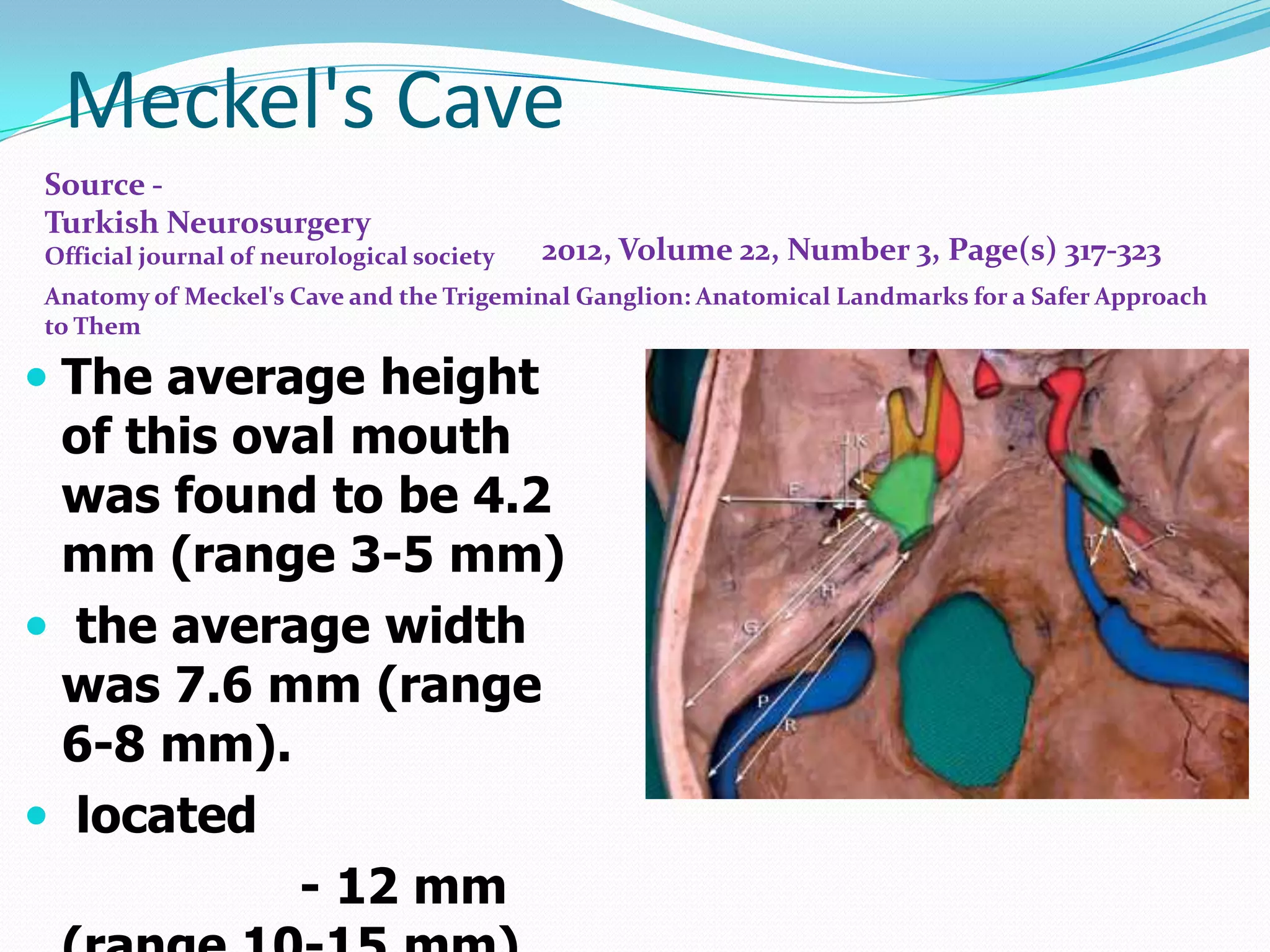 Meckel's Cave
 The average height
of this oval mouth
was found to be 4.2
mm (range 3-5 mm)
 the average width
was 7.6 mm (range
6-8 mm).
 located
- 12 mm
Source -
Turkish Neurosurgery
Official journal of neurological society
Anatomy of Meckel's Cave and the Trigeminal Ganglion: Anatomical Landmarks for a Safer Approach
to Them
2012, Volume 22, Number 3, Page(s) 317-323
 