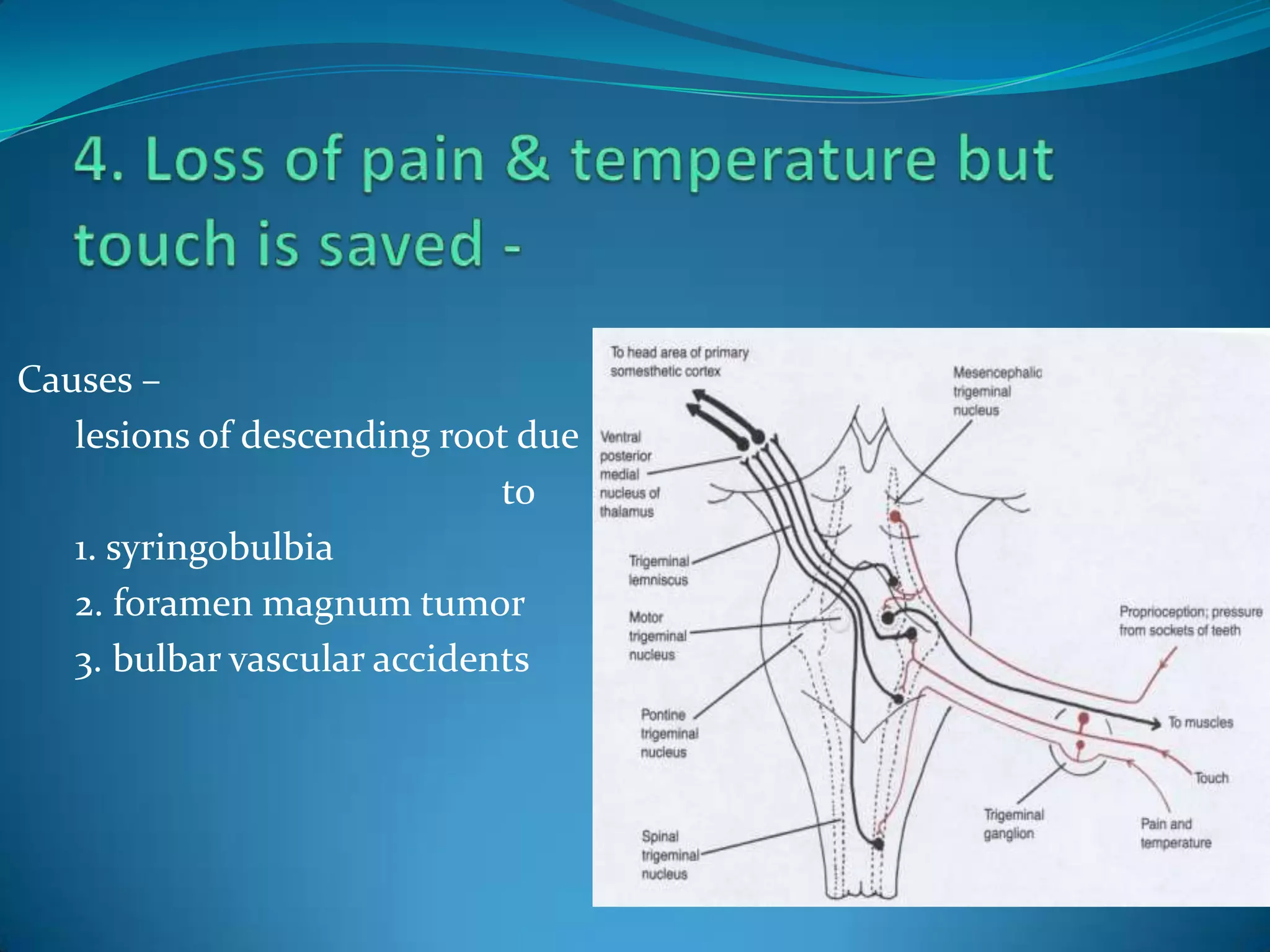 Causes –
lesions of descending root due
to
1. syringobulbia
2. foramen magnum tumor
3. bulbar vascular accidents
 