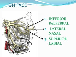 ON FACE
1. INFERIOR
PALPEBRAL
2. LATERAL
NASAL
3. SUPERIOR
LABIAL
 