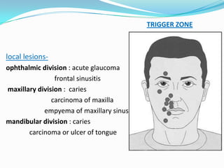 local lesions-
ophthalmic division : acute glaucoma
frontal sinusitis
maxillary division : caries
carcinoma of maxilla
empyema of maxillary sinus
mandibular division : caries
carcinoma or ulcer of tongue
TRIGGER ZONE
 