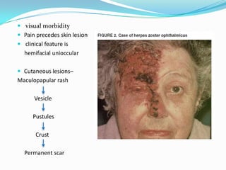  visual morbidity
 Pain precedes skin lesion
 clinical feature is
hemifacial unioccular
 Cutaneous lesions–
Maculopapular rash
Vesicle
Pustules
Crust
Permanent scar
 