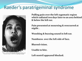 Raeder’s paratrigeminal syndrome
Pulling pain over the left zygomatic region
which radiated two days later to an area behind
& below the left ear.
Pain presented at mourning & reoccurred at
nigtht .
Wooshing & buzzing sound in left ear.
Numbness over the left side of face.
Blurred vision.
Unable to bite.
Left nostril appeared blocked.
 