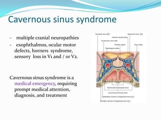 Cavernous sinus syndrome
- multiple cranial neuropathies
- exophthalmos, ocular motor
defects, horners syndrome,
sensory loss in V1 and / or V2.
Cavernous sinus syndrome is a
medical emergency, requiring
prompt medical attention,
diagnosis, and treatment
 