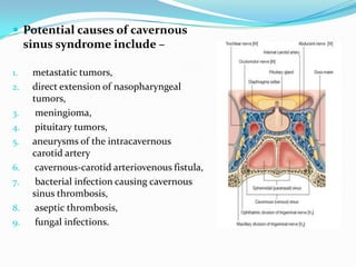  Potential causes of cavernous
sinus syndrome include –
1. metastatic tumors,
2. direct extension of nasopharyngeal
tumors,
3. meningioma,
4. pituitary tumors,
5. aneurysms of the intracavernous
carotid artery
6. cavernous-carotid arteriovenous fistula,
7. bacterial infection causing cavernous
sinus thrombosis,
8. aseptic thrombosis,
9. fungal infections.
 