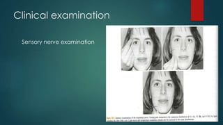 Clinical examination 
Sensory nerve examination 
 