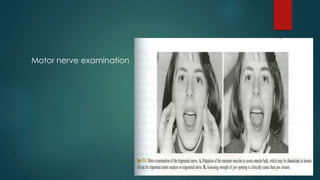 Motor nerve examination 
 