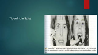 Trigeminal reflexes 
 