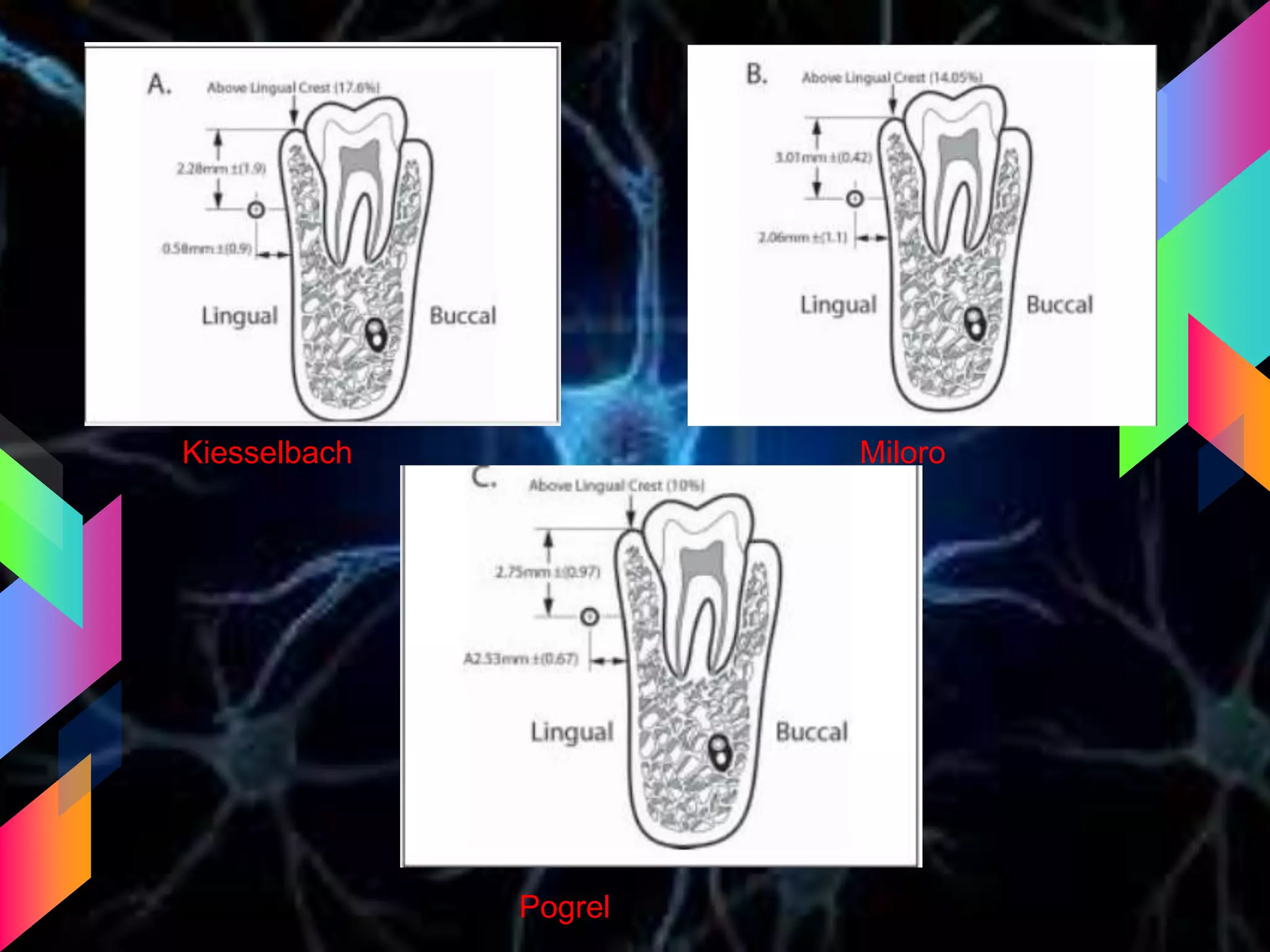 Kiesselbach Miloro
Pogrel
 
