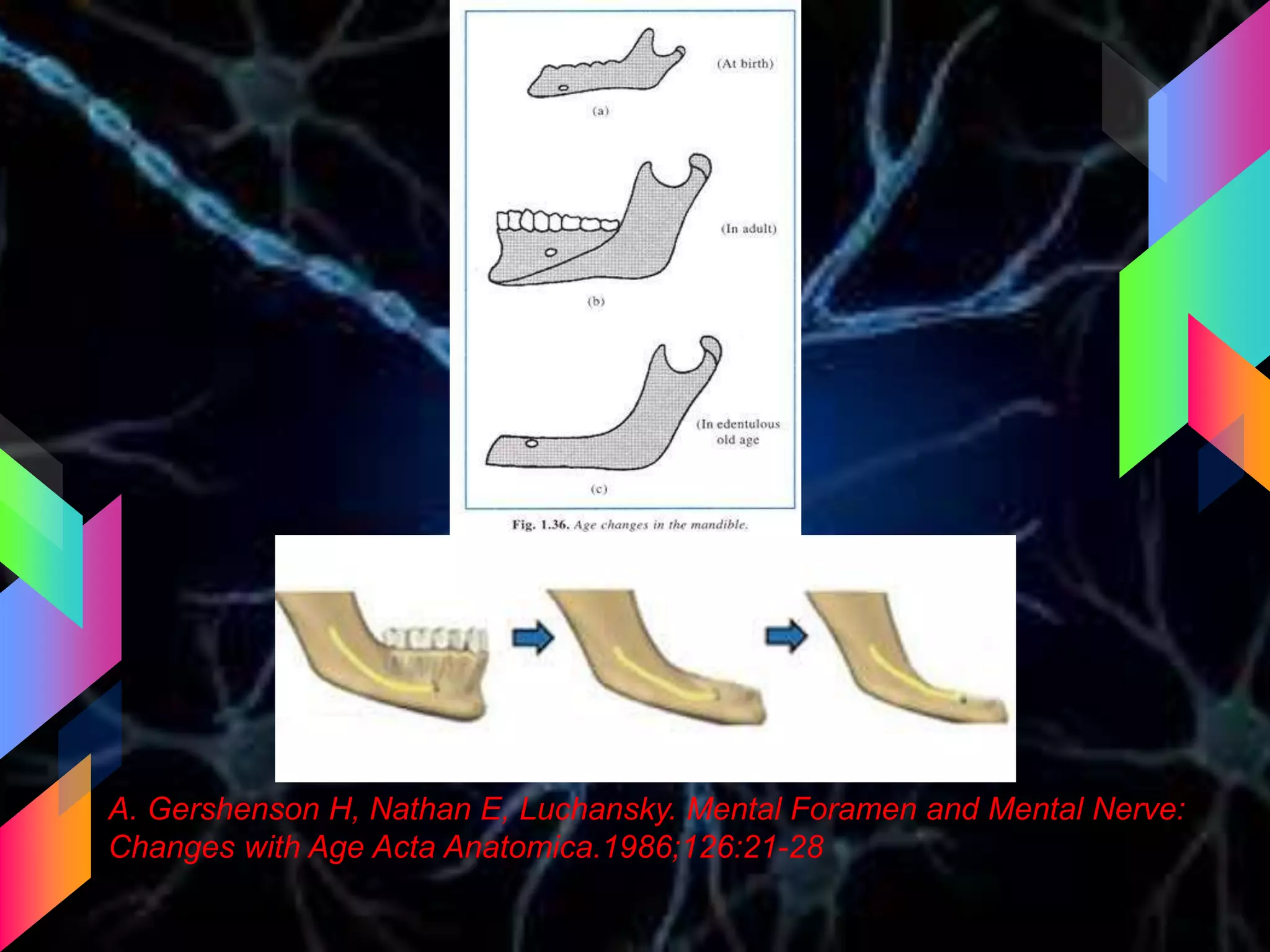 A. Gershenson H, Nathan E, Luchansky. Mental Foramen and Mental Nerve:
Changes with Age Acta Anatomica.1986;126:21-28
 
