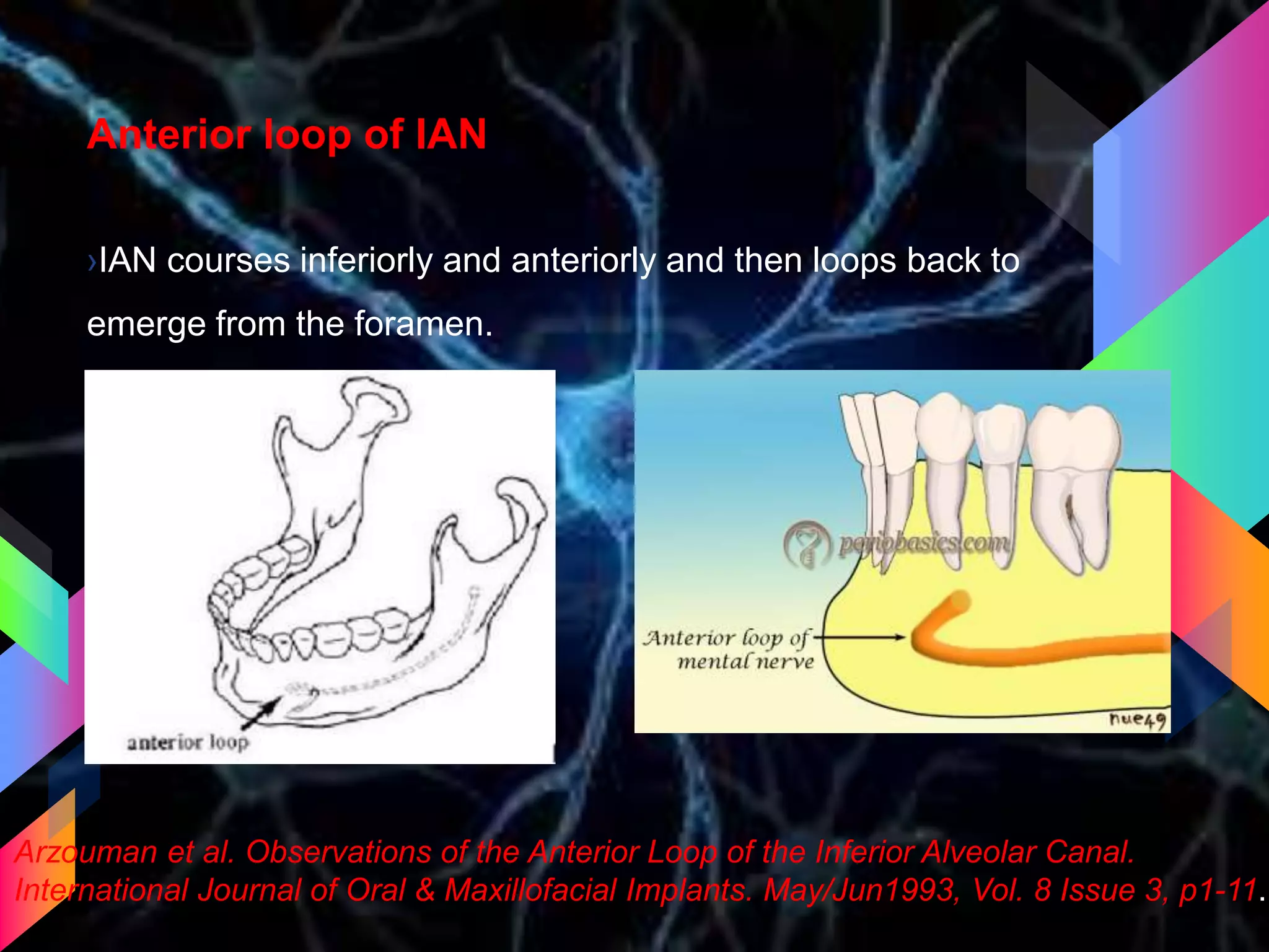 Anterior loop of IAN
›IAN courses inferiorly and anteriorly and then loops back to
emerge from the foramen.
Arzouman et al. Observations of the Anterior Loop of the Inferior Alveolar Canal.
International Journal of Oral & Maxillofacial Implants. May/Jun1993, Vol. 8 Issue 3, p1-11.
 