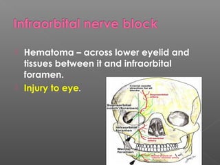  Hematoma – across lower eyelid and
tissues between it and infraorbital
foramen.
 Injury to eye.
 