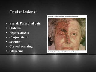 Ocular lesions:
• Eyelid: Perorbital pain
• Oedema
• Hyperasthesia
• Conjunctivitis
• Scleritis
• Corneal scarring
• Glaucoma
 