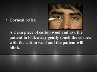 • Corneal reflex
A clean piece of cotton wool and ask the
patient to look away gently touch the cornea
with the cotton wool and the patient will
blink.
 