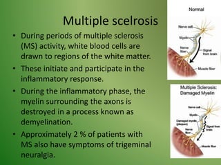 Multiple scelrosis
• During periods of multiple sclerosis
(MS) activity, white blood cells are
drawn to regions of the white matter.
• These initiate and participate in the
inflammatory response.
• During the inflammatory phase, the
myelin surrounding the axons is
destroyed in a process known as
demyelination.
• Approximately 2 % of patients with
MS also have symptoms of trigeminal
neuralgia.
 