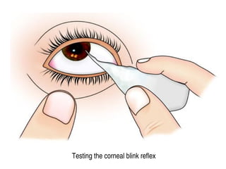 Testing the corneal blink reflex
 