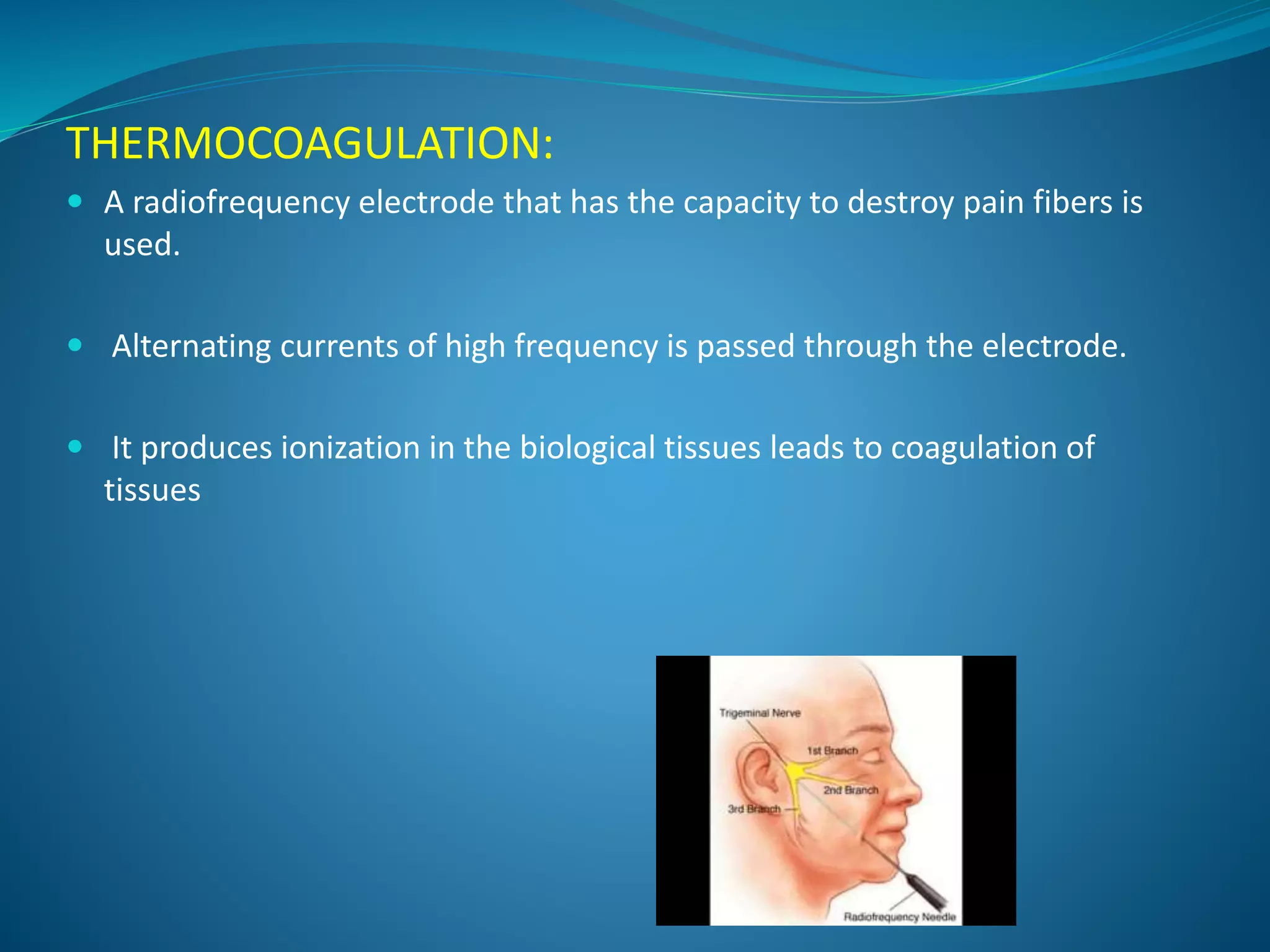 THERMOCOAGULATION:
 A radiofrequency electrode that has the capacity to destroy pain fibers is
used.
 Alternating currents of high frequency is passed through the electrode.
 It produces ionization in the biological tissues leads to coagulation of
tissues
 