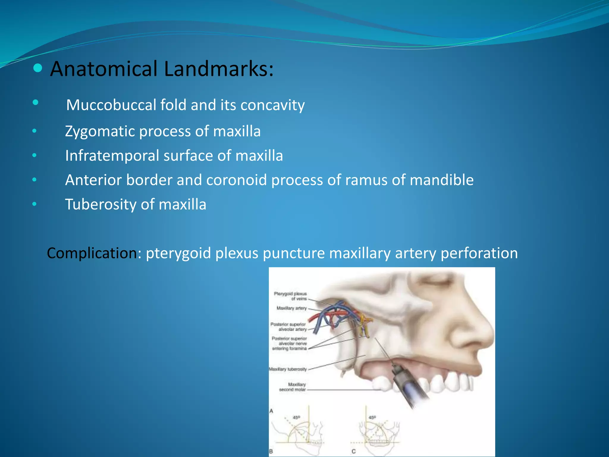 Anatomical Landmarks:
• Muccobuccal fold and its concavity
• Zygomatic process of maxilla
• Infratemporal surface of maxilla
• Anterior border and coronoid process of ramus of mandible
• Tuberosity of maxilla
Complication: pterygoid plexus puncture maxillary artery perforation
 