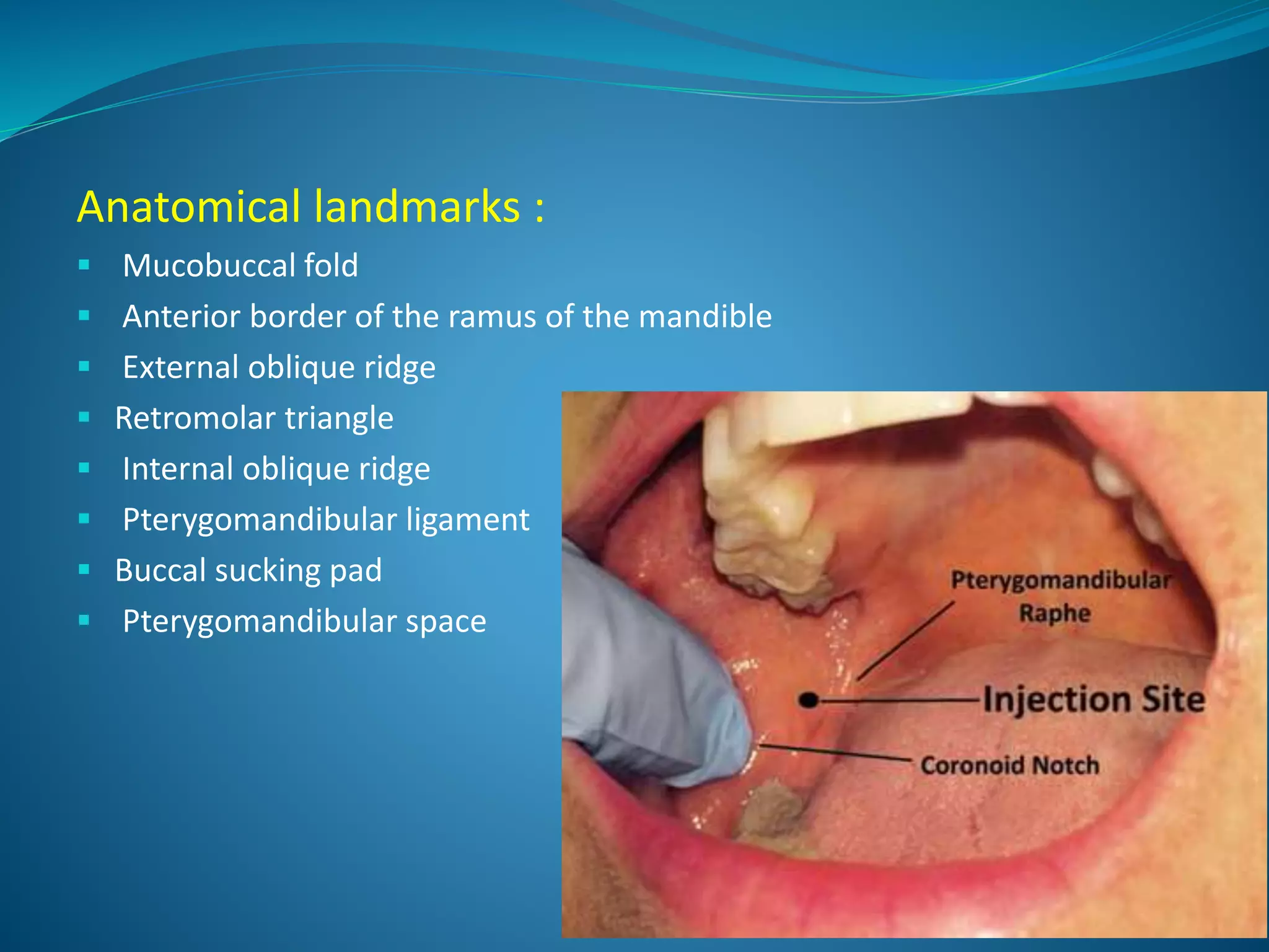 Anatomical landmarks :
 Mucobuccal fold
 Anterior border of the ramus of the mandible
 External oblique ridge
 Retromolar triangle
 Internal oblique ridge
 Pterygomandibular ligament
 Buccal sucking pad
 Pterygomandibular space
 
