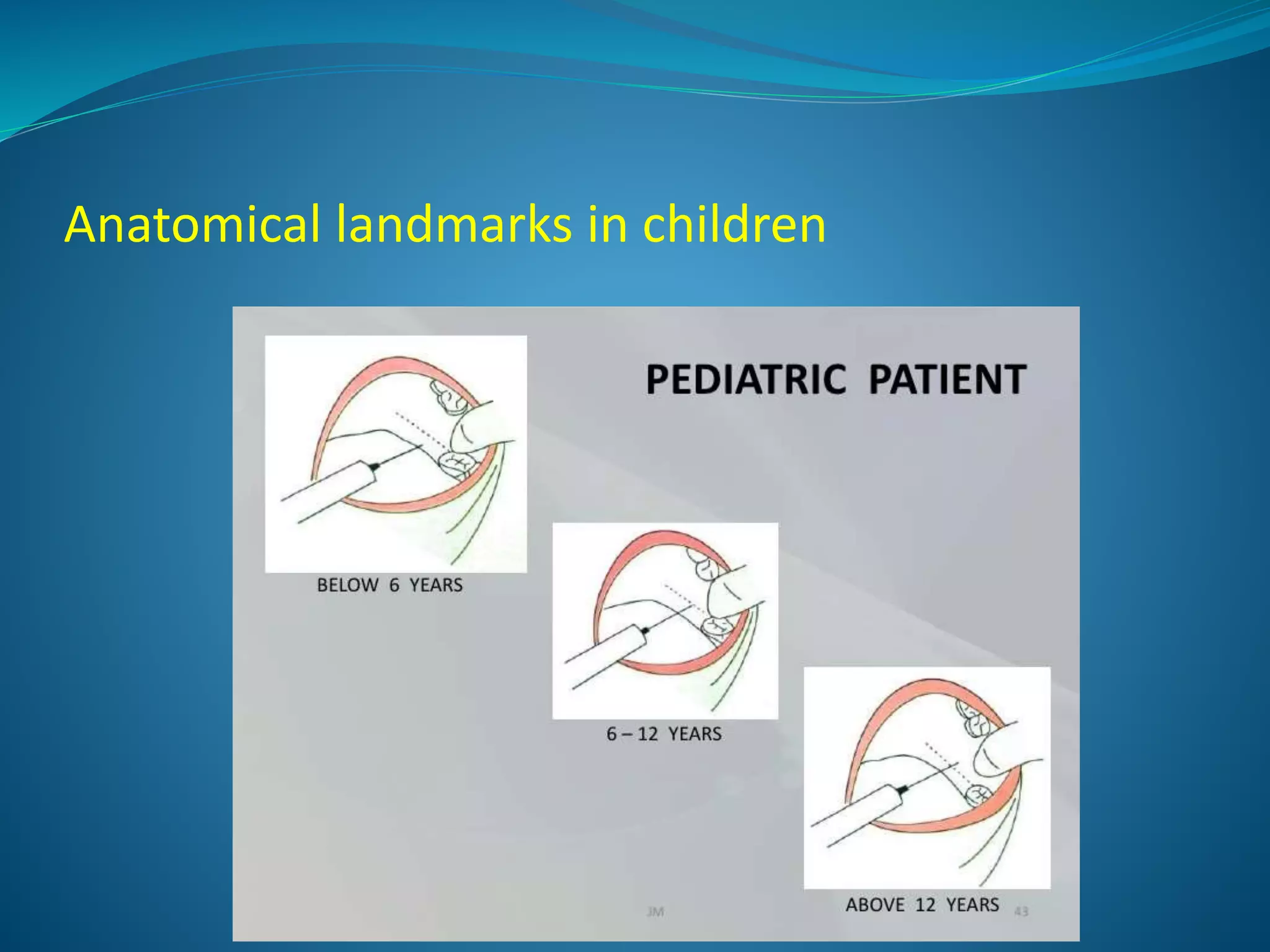 Anatomical landmarks in children
 