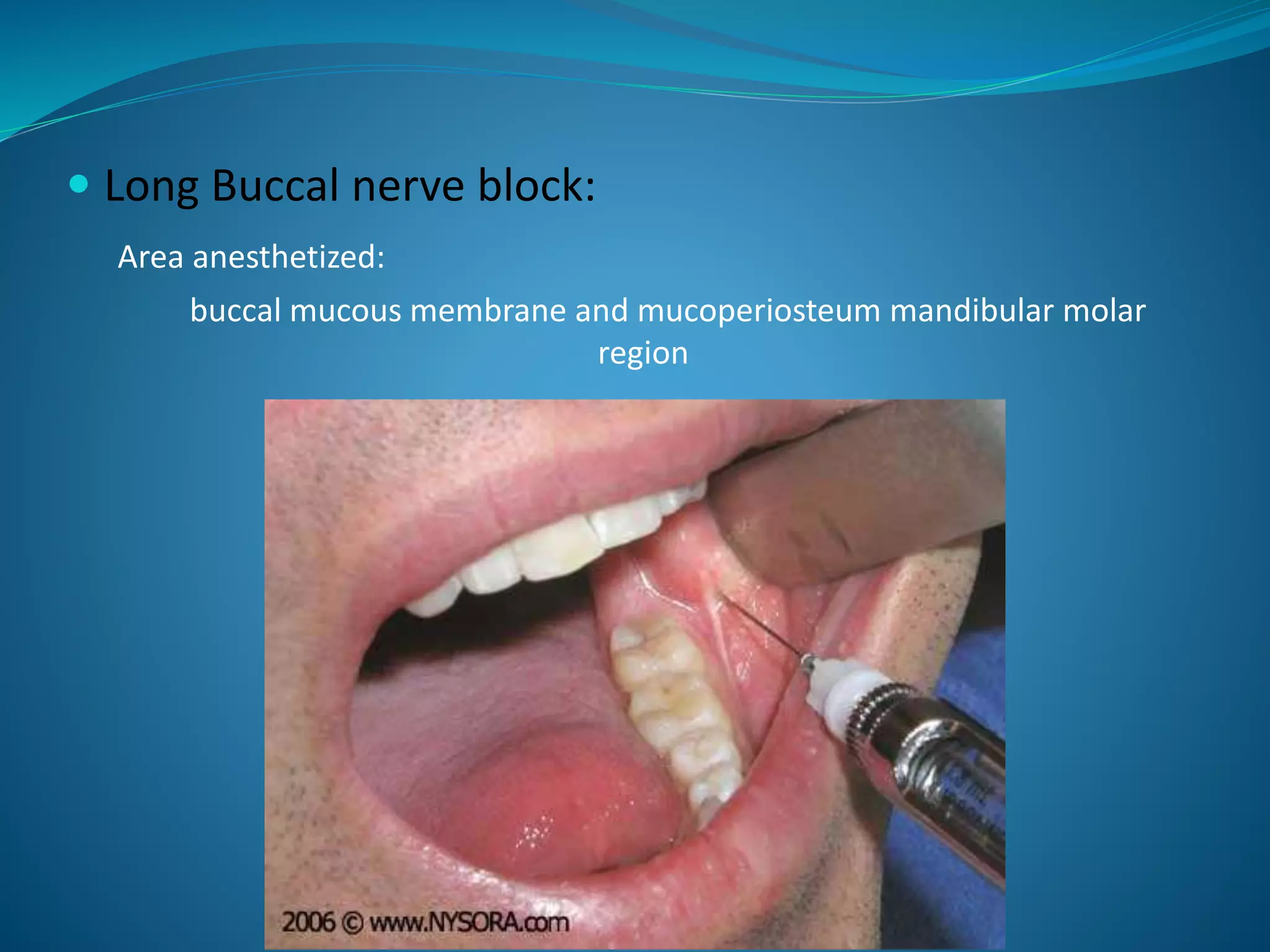  Long Buccal nerve block:
Area anesthetized:
buccal mucous membrane and mucoperiosteum mandibular molar
region
 